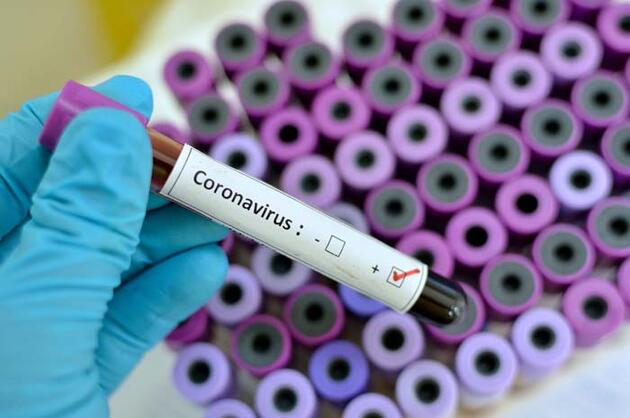 Koronavirüse karşı nasıl beslenmeliyiz?