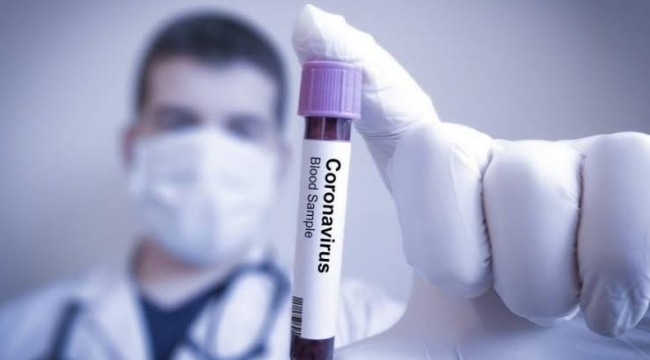   Koronavirüsle mücadelede ölüm oranını 3'te 1 oranında azaltan ilaç keşfeldildi