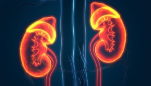 Böbrek kanseri erkeklerde daha fazla görülüyor! Belirtileri...