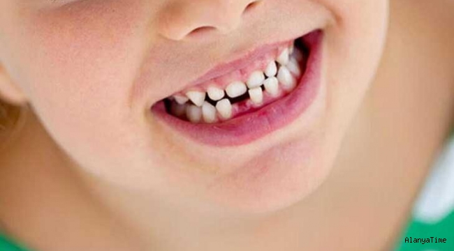 Çocuklardaki diş travmasına nasıl müdahale edilmeli?