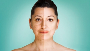 Güneş lekelerini önlemenin en kolay yolu! - Güneş lekesine kesin çözüm