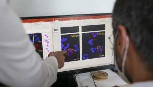 Kanserde çığır açacak: Türk bilim insanları şifresini çözdü!