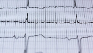 Sıcaklarda kalp hastalıkları yine arttı! Kendinizi korumak için...