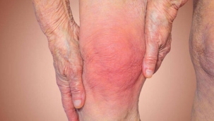 Yetersiz fiziksel aktivite yaşlılarda kas erimesini artırıyor!