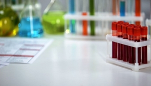 Anemi hangi hastalıkların habercisi?