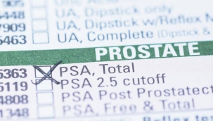 Erkeklerde PSA testi ne işe yarıyor? - PSA testi neden yapılır?