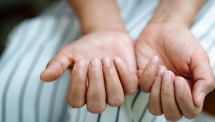 Tırnaklarınızdaki beyaz noktalar ne anlama geliyor?