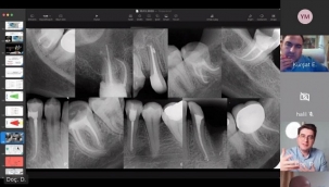 ALANYA ALKÜ HIZ KESMİYOR