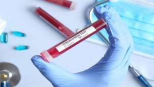 Sağlık Bakanlığından dolandırıcılık' uyarısı: Çağrı ve mesajlara itibar etmeyin