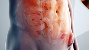 'Kasık fıtığı kabusunuz olmasın'