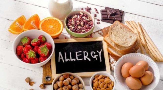 Gıda alerjisi nedir?