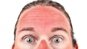 'Bronzlaşma aslında derinin kendini koruma mekanizmasıdır'