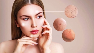 Cilt lekelerinin sebebi nedir ve nasıl yok ederiz?