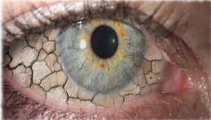 Kuru göz hastalığına dikkat!