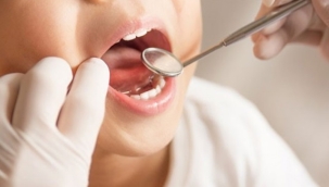 Süt dişleri düşeceği zamana kadar korunmalı