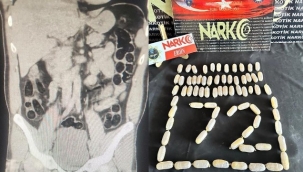 İranlı şüphelinin midesinden 76 pakette 714 gram eroin çıktı