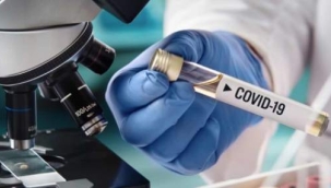 Kovid-19'un yeni varyantında tat ve koku kaybı geri döndü