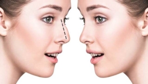 Burun estetiği sonrası bunlara dikkat