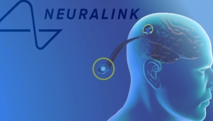 Elon Musk'un beyin çipi şirketi Neuralink'in beyin çipi projesinde ikinci aşamaya başlıyor