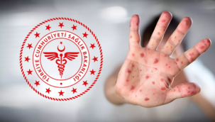 Sağlık Bakanlığı, 'maymun çiçeği virüsü' rehberi yayımladı