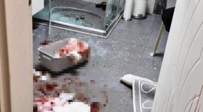 Duşakabin patladı, eline 20'ye yakın dikiş atıldı 