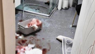 Duşakabin patladı, eline 20'ye yakın dikiş atıldı 