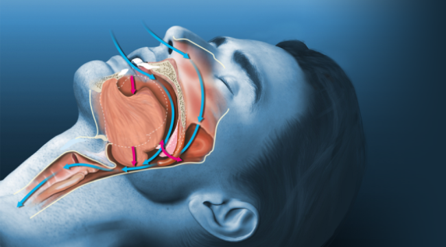  "Uyku apnesi ani ölümlere yol açabilir"
