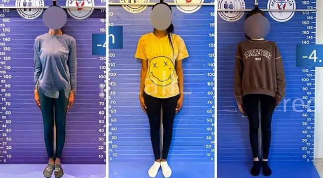 Yeni trend 'boy kısaltmak': Ameliyat için Türkiye'ye geliyorlar, uzmanlar ise 'riskli' diyor
