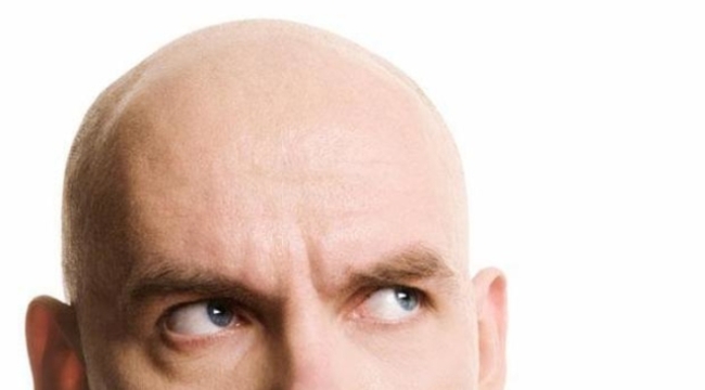 Erkek tipi kellik için ilaç bulundu