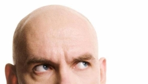 Erkek tipi kellik için ilaç bulundu