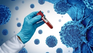 Kanser tedavisinde yeni teknik: Kök hücreler kanserle mücadele için kullanılacak